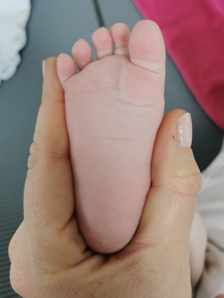 Man sieht einen Kinderfuß von unten.
