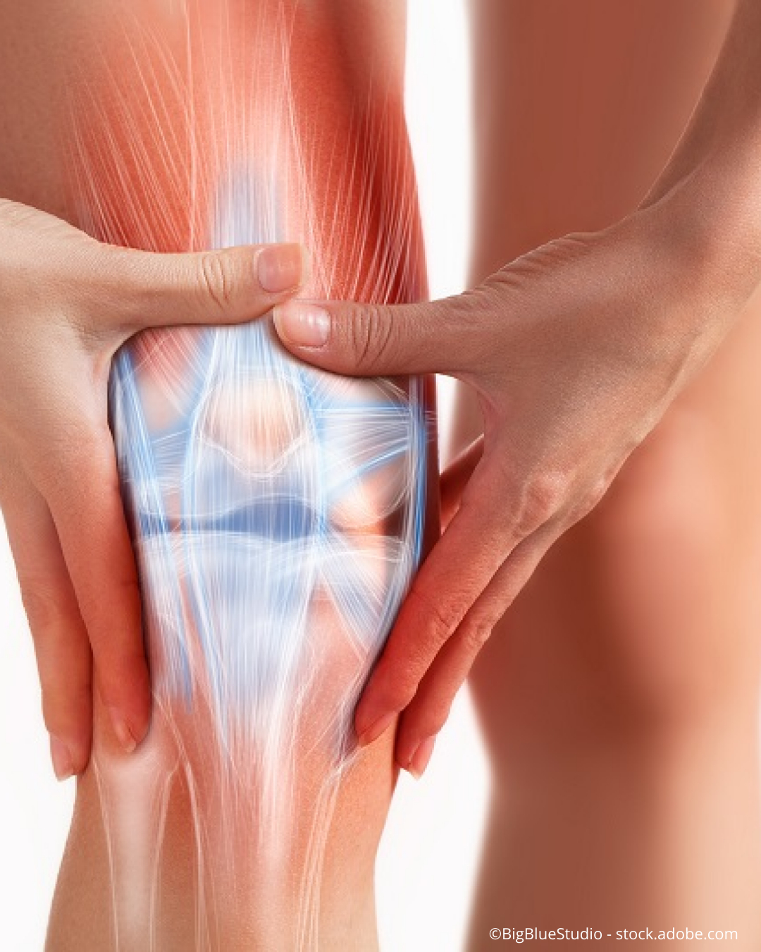 Anatomische Abbildung des Knieknorpels im Knie.