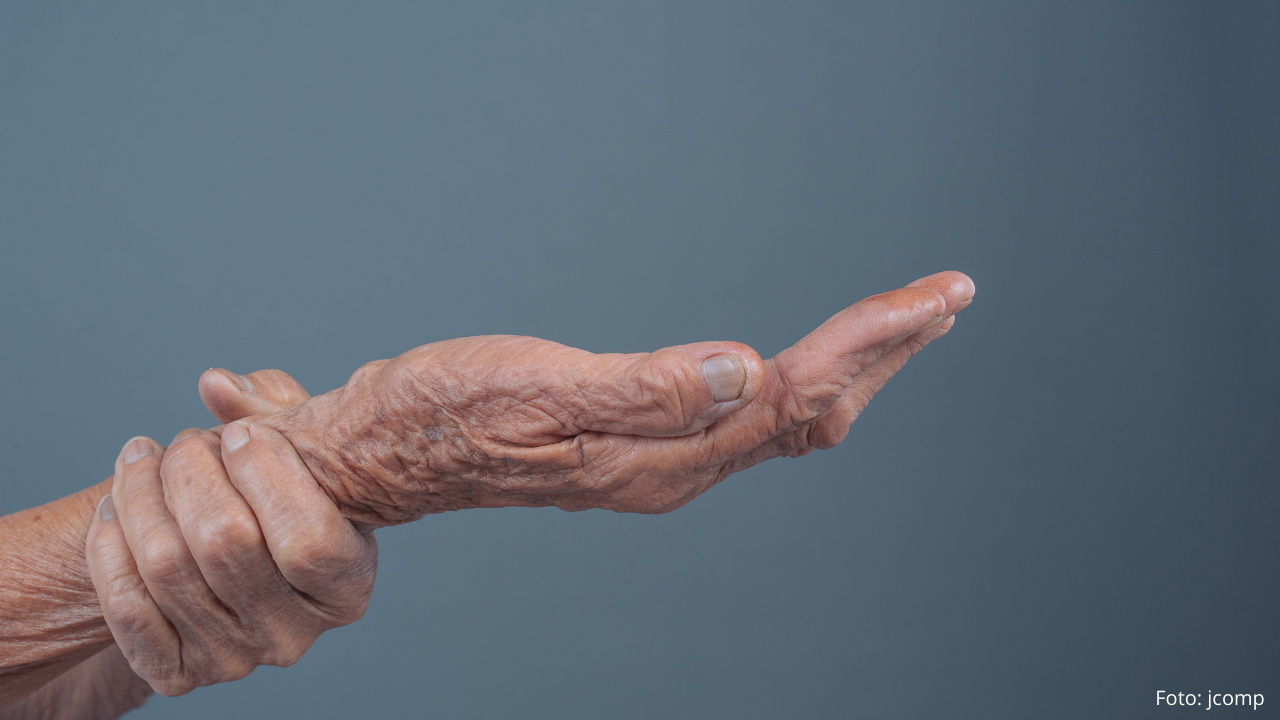 Bild zeigt die Hand einer älteren Person. Die Handfläche ist nach oben gedreht. Die andere Hand umschließt das Handgelenk.